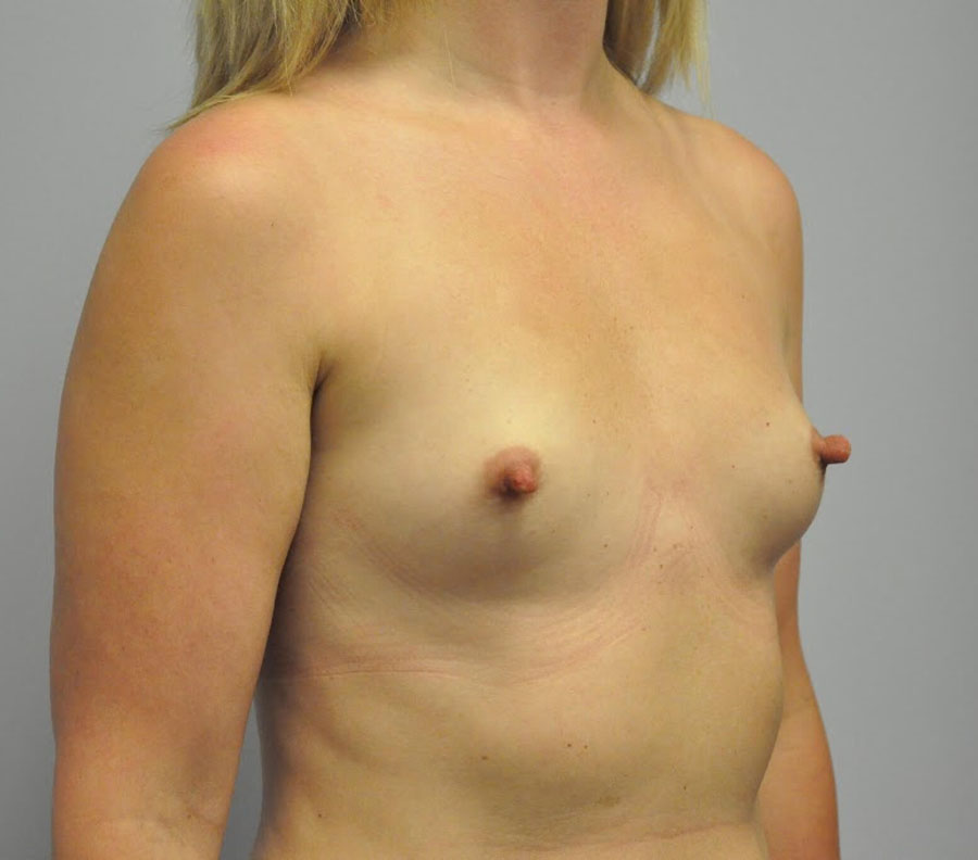 5080-p03-5-2