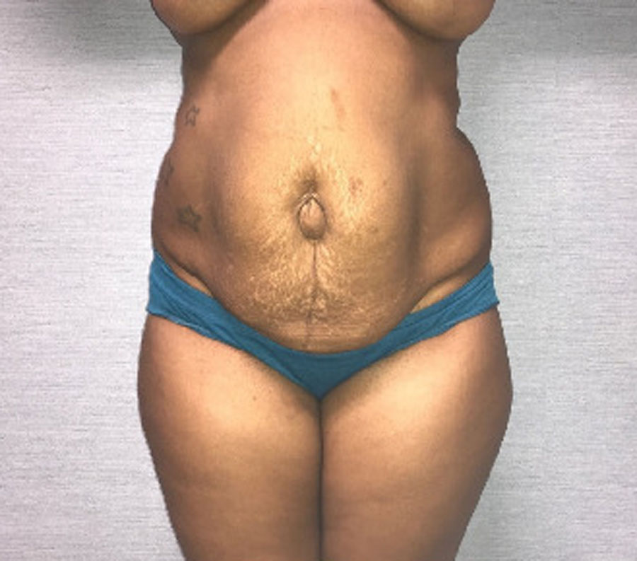 5191-p05-1-3