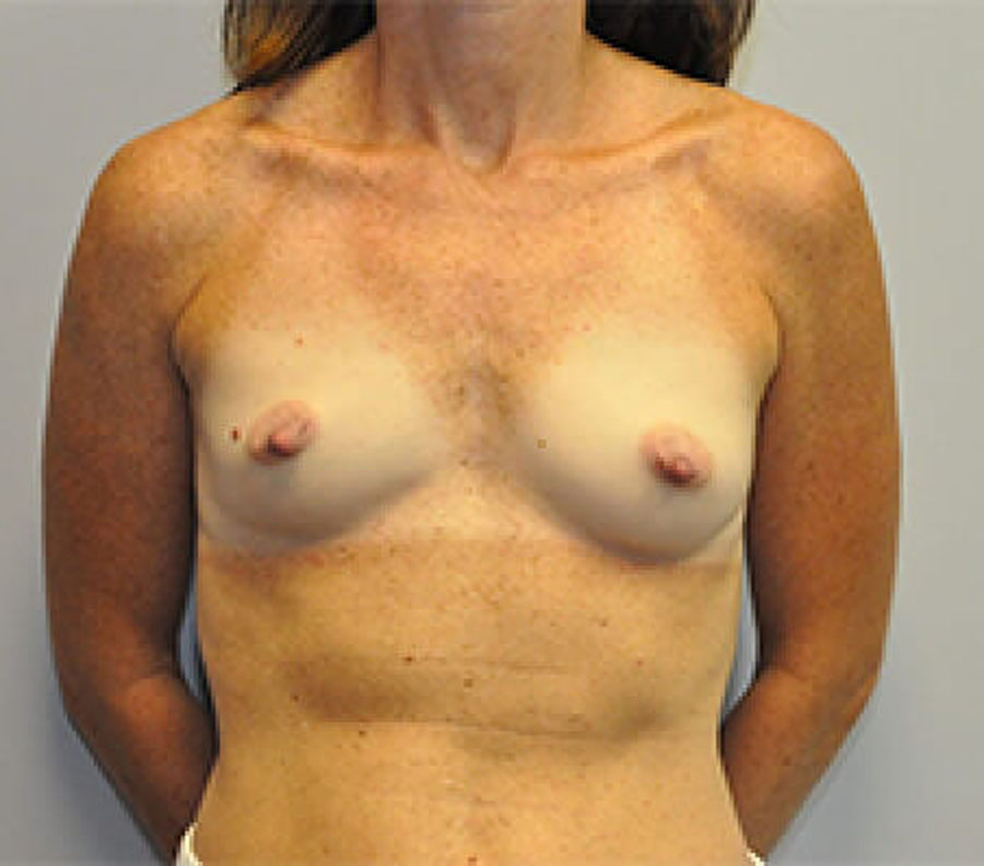 5096-p06-1-2