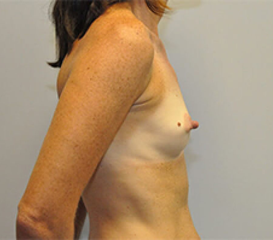 5099-p06-3-1